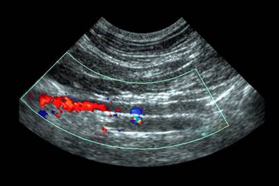 Ecografía Abdominal en Concepción